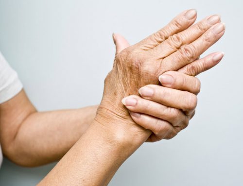 Rheumatoid Arthritis of the Wrist