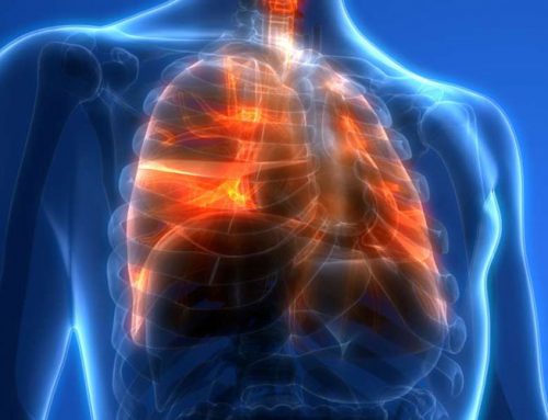 Effects of Air Pollution on Lungs