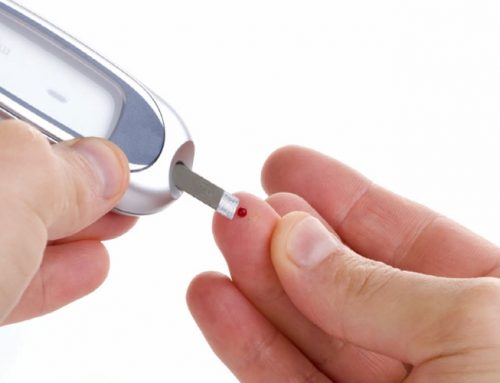 Management of Type 2 Diabetes Associated with Obesity