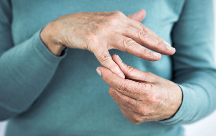 Which is the best medicine for arthritis?