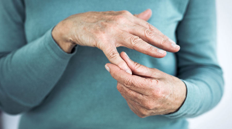 Which is the best medicine for arthritis?