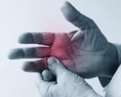 10 Tips for Managing an Arthritis Flare